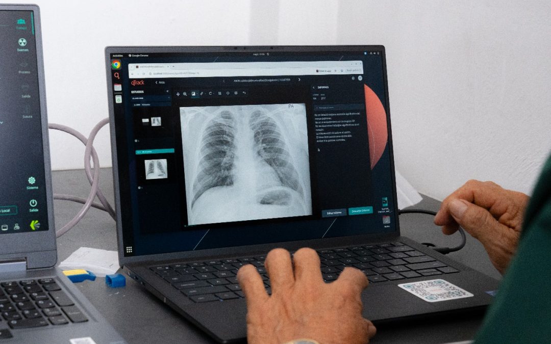 GORE CUENTA CON DOS EQUIPOS DE RADIOGRAFÍA CON INTELIGENCIA ARTIFICIAL QUE PERMITE DETECTAR TBC EN MINUTOS